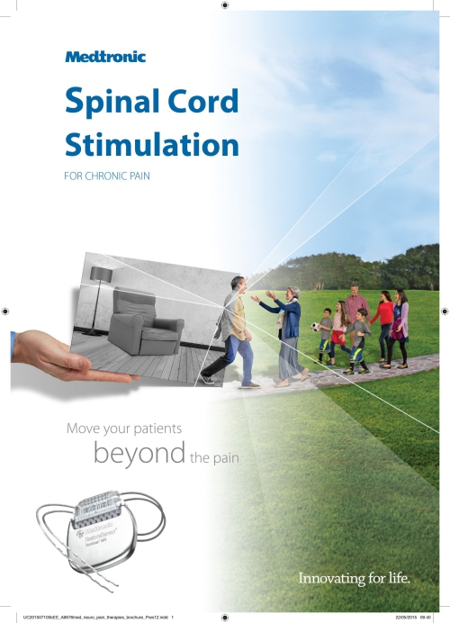 SCS (Spinal Cord Stimulation)